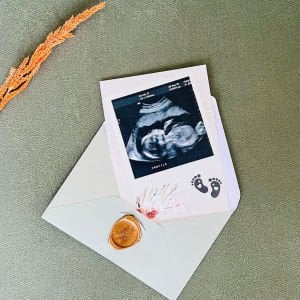 Baba Oluyorsun Bebek Müjde Kartı – En Özel Duygu