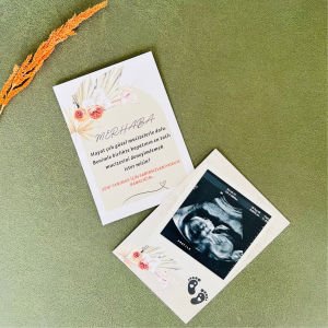 Baba Oluyorsun Bebek Müjde Kartı – En Tatlı Mucize