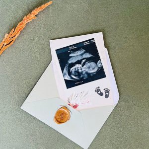 En Tatlı Mucize Bebek Müjde Kartı – Baba Oluyorsun
