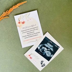 Teyze Oluyorsun Bebek Müjde Kartı - Can Parçası