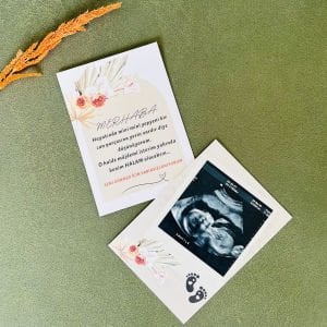Hala Oluyorsun Bebek Müjde Kartı – Can Parçası