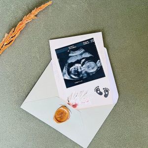 Yeni Bir Neşe Kaynağı Bebek Müjde Kartı – Dede Oluyorsun